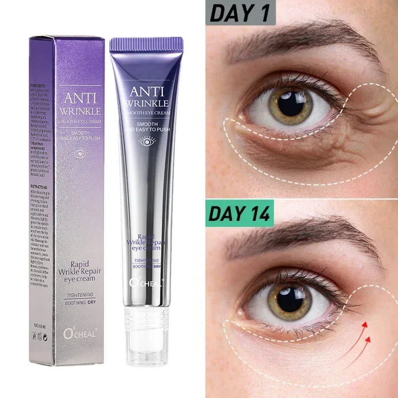 Roller Massager Eye Cream Anti Wrinkle Eye Bags Anti Dark Circle Moisturizing Bioaqua Eye Contour Korean Skin Care Cosmetics